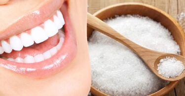 Cách làm trắng răng bằng muối CHUẨN BÀI