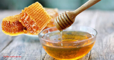 Hướng dẫn chữa viêm lợi bằng mật ong hiệu quả